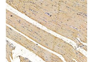 ABIN7096210 and ABIN7100272 at 1/100 staining rat muscle tissue by IHC-P. (RWDD2B Antikörper)