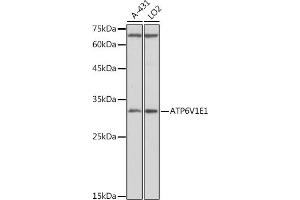 Western blot analysis of extracts of various cell lines, using V1E1 antibody (ABIN1678795, ABIN3018056, ABIN3018057 and ABIN6220346) at 1:1000 dilution. (ATP6V1E1 Antikörper  (AA 77-226))