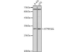 Western blot analysis of extracts of various cell lines, using V1E1 antibody (ABIN1678795, ABIN3018056, ABIN3018057 and ABIN6220346) at 1:1000 dilution.