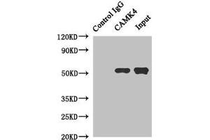 Immunoprecipitating CAMK4 in Jurkat whole cell lysate Lane 1: Rabbit control IgG instead of (1 μg) instead of ABIN7146449 in Jurkat whole cell lysate. (CAMK4 Antikörper  (AA 304-473))