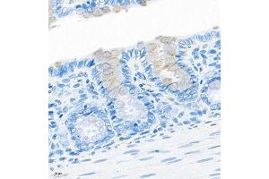 Immunohistochemistry of paraffin embedded rat colon using CNTROB (ABIN7073427) at dilution of 1:200 (400x lens) (CNTROB Antikörper)