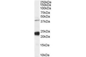 Image no. 1 for anti-GIPC PDZ Domain Containing Family, Member 1 (GIPC1) (C-Term) antibody (ABIN374381) (GIPC1 Antikörper  (C-Term))