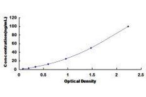 VEGF Receptor 2 (VEGFR2) ELISA Kit