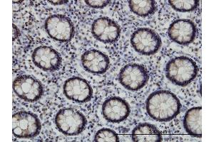 Immunoperoxidase of monoclonal antibody to EP300 on formalin-fixed paraffin-embedded human colon. (p300 Antikörper  (AA 731-830))