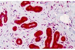 Human Breast: Formalin-Fixed, Paraffin-Embedded (FFPE) (Caspase 4 Antikörper)