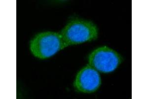 IF analysis of GGCX using anti-GGCX antibody (ABIN7602419).