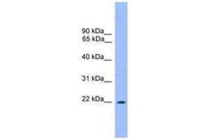 Image no. 1 for anti-Dorsal Root Ganglia Homeobox (DRGX) (AA 151-200) antibody (ABIN6744666) (DRGX Antikörper  (AA 151-200))