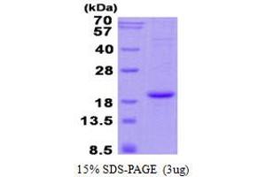 Image no. 1 for Hemoglobin, alpha 2 (HBa2) protein (His tag) (ABIN1098667) (HBa2 Protein (His tag))
