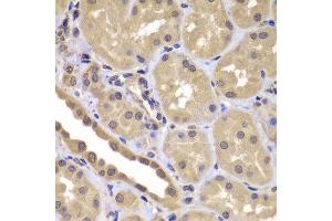 Immunohistochemistry of paraffin-embedded human kidney using BAG2 antibody at dilution of 1:100 (40x lens).