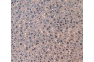 Used in DAB staining on fromalin fixed paraffin- embedded liver tissue (TOP2 Antikörper  (AA 1079-1328))