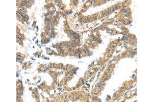 Immunohistochemistry (IHC) image for anti-Potassium Voltage-Gated Channel, Subfamily G, Member 3 (KCNG3) antibody (ABIN2433240) (KCNG3 Antikörper)