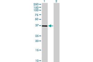 Western Blot analysis of ST3GAL1 expression in transfected 293T cell line by ST3GAL1 MaxPab polyclonal antibody. (ST3GAL1 Antikörper  (AA 1-340))