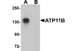 Western Blotting (WB) image for anti-ATPase, Class VI, Type 11B (ATP11B) (N-Term) antibody (ABIN1031250) (ATP11B Antikörper  (N-Term))