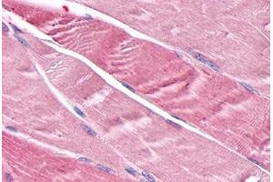 Anti-TNIK antibody  ABIN1049422 IHC staining of human skeletal muscle, myocytes. (TNIK Antikörper  (Internal Region))