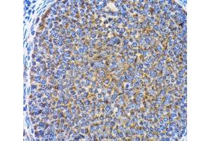 Immunohistochemistry of paraffin-embedded Rat ovary using MAP1LC3A Polyclonal Antibody at dilution of 1:100 (40x lens). (MAP1LC3A Antikörper)