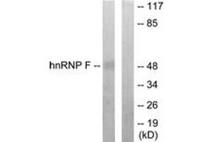 Western blot analysis of extracts from HepG2 cells, using hnRNP F Antibody.