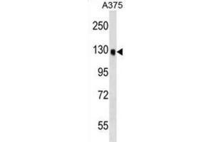Western Blotting (WB) image for anti-Oxysterol Binding Protein-Like 6 (OSBPL6) antibody (ABIN2999484) (OSBPL6 Antikörper)