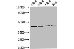 Western Blot Positive WB detected in: Rosseta bacteria lysate at 40 μg, 20 μg, 10 μg, 5 μg All lanes: metC antibody at 0. (MetC (AA 1-392) Antikörper (Biotin))