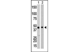 The anti-CKB Pab (ABIN391074 and ABIN2841221) is used in Western blot to detect CKB in Y79 cell lysate (Lane 1) and mouse colon tissue lysate (Lane 2).
