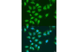 Immunofluorescence analysis of U2OS cells using EY antibody (ABIN7267073) at dilution of 1:100. (EYA3 Antikörper  (AA 1-300))