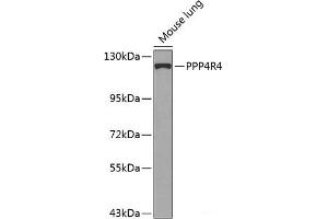 Western blot analysis of extracts of Mouse lung using PPP4R4 Polyclonal Antibody at dilution of 1:1000. (PPP4R4 Antikörper)