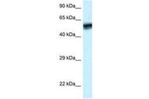 Image no. 1 for anti-Calcium/calmodulin-Dependent Protein Kinase IV (CAMK4) (AA 53-102) antibody (ABIN6747334) (CAMK4 Antikörper  (AA 53-102))