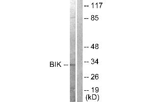 Western blot analysis of extracts from A549 cells, treated with DMSO (0. (BIK Antikörper  (Thr33))