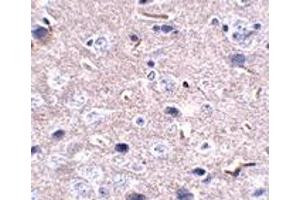 Immunohistochemistry (IHC) image for anti-Programmed Cell Death 1 (PDCD1) antibody (ABIN1031790) (PD-1 Antikörper)