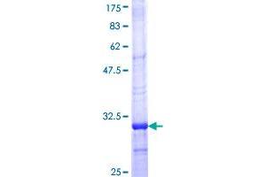 Mitochondrially Encoded NADH Dehydrogenase 4 (MT-ND4) (AA 406-459) protein (GST tag)