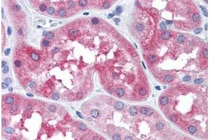 Human Kidney: Formalin-Fixed, Paraffin-Embedded (FFPE) (MAPT Antikörper  (Ser404))