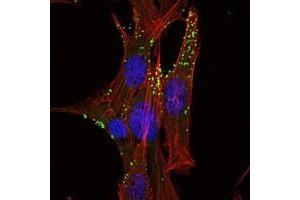 Immunofluorescence analysis of NIH/3T3 cells using KLHL1 antibody (green). (KLHL1 Antikörper)