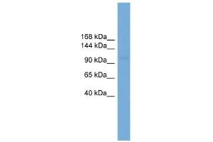 WB Suggested Anti-SLC9A3 Antibody Titration:  0. (SLC9A3 Antikörper  (Middle Region))