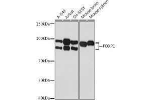 Western blot analysis of extracts of various cell lines, using FOXP1 Rabbit mAb (ABIN7267247) at 1:1000 dilution. (FOXP1 Antikörper)