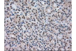 Image no. 6 for anti-Cancer/testis Antigen 1B (CTAG1B) antibody (ABIN1499905) (CTAG1B Antikörper)