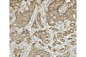 IHC analysis of Methylmalonyl Coenzyme A using anti-Methylmalonyl Coenzyme A antibody (ABIN7603112). (MUT Antikörper  (N-Term))