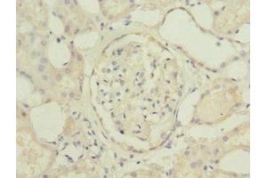 Immunohistochemistry of paraffin-embedded human kidney tissue using ABIN7174771 at dilution of 1:100 (C19orf48 Antikörper  (AA 1-117))