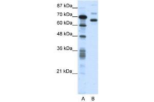 WB Suggested Anti-CTCFL  Antibody Titration: 0. (CTCFL Antikörper  (N-Term))