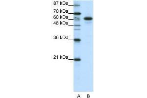 WB Suggested Anti-CBLL1 Antibody Titration:  1. (CBLL1 Antikörper  (C-Term))