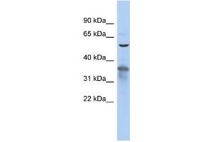 WB Suggested Anti-RAB3IP Antibody Titration: 0. (RAB3IP Antikörper  (N-Term))