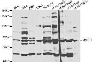 Western blot analysis of extracts of various cell lines, using MCPH1 antibody (ABIN5973185) at 1/1000 dilution. (MCPH1 Antikörper)