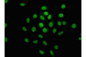 Immunofluorescence staining of A549 cells with ABIN7150334 at 1:100, counter-stained with DAPI. (MCM4 Antikörper  (AA 2-141))
