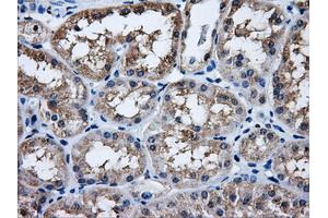Immunohistochemical staining of paraffin-embedded Kidney tissue using anti-HDAC10mouse monoclonal antibody. (HDAC10 Antikörper)