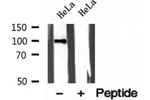 Western blot analysis of extracts of HeLa cells, using LONP1 antibody. (LONP1 Antikörper  (C-Term))