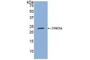 Detection of Recombinant TIMP1, Human using Polyclonal Antibody to Tissue Inhibitors Of Metalloproteinase 1 (TIMP1) (TIMP1 Antikörper  (AA 25-207))