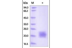 SDS-PAGE (SDS) image for Cytotoxic T-Lymphocyte-Associated Protein 4 (CTLA4) (AA 37-160) (Active) protein (His tag) (ABIN2180926)