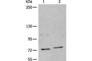 Western blot analysis of 562 and Jurkat cell lysates using NCAPH Polyclonal Antibody at dilution of 1:450 (NCAPH Antikörper)