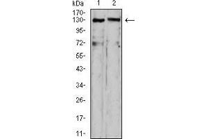 Western blot analysis using OTUD4 mouse mAb against HepG2 (1) and C6 (2) cell lysate. (OTUD4 Antikörper  (AA 815-1049))