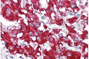 Human Adrenal (formalin-fixed, paraffin-embedded) stained with BAG1 antibody ABIN214400 at 2. (BAG1 Antikörper  (N-Term))