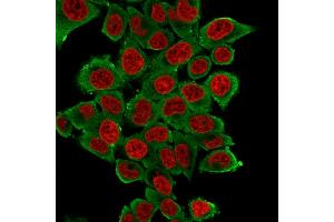 Immunofluorescence Analysis of HeLa cells labeling Smooth Muscle Actin with Smooth Muscle Actin Mouse Monoclonal Antibody (SPM322) followed by Goat anti-Mouse IgG-CF488(Green).