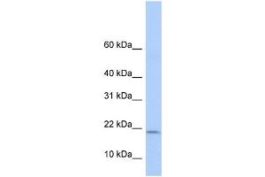 WB Suggested Anti-POLR1D Antibody Titration:  0.
